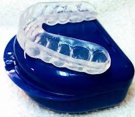 Clear Aligners