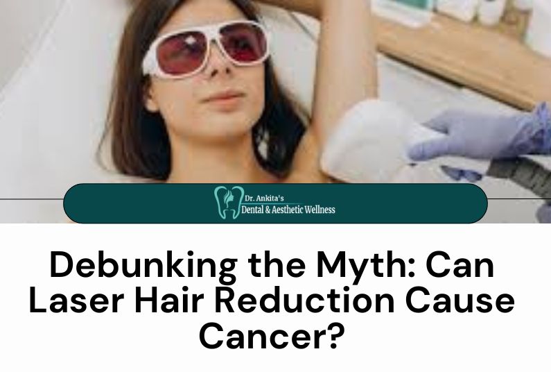 Debunking The Myth: Can Laser Hair Reduction Cause Cancer?