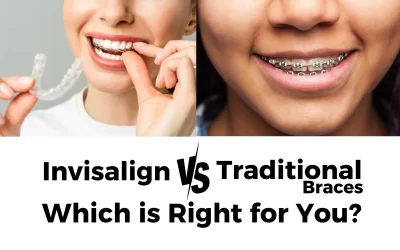 Invisalign vs. Traditional Braces