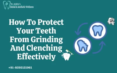 How To Protect Your Teeth From Grinding And Clenching Effectively