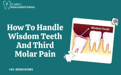 How To Handle Wisdom Teeth And Third Molar Pain