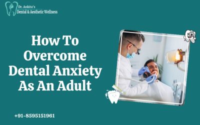 How To Overcome Dental Anxiety As An Adult