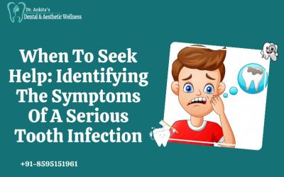 When To Seek Help: Identifying The Symptoms Of A Serious Tooth Infection