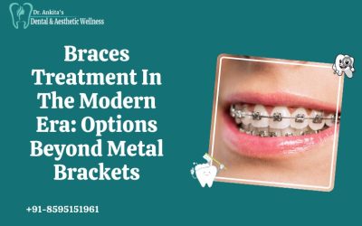 Braces Treatment In The Modern Era: Options Beyond Metal Brackets