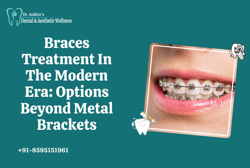 Braces Treatment In The Modern Era: Options Beyond Metal Brackets